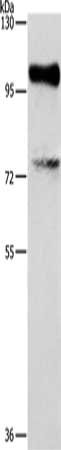 EZH2 Antibody