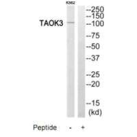 TAOK3 Antibody