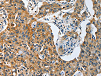 TNFSF13 Antibody