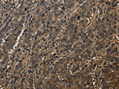 GSTO1 Antibody