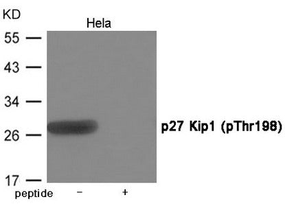 Phospho-CDKN1B (Thr198) Antibody
