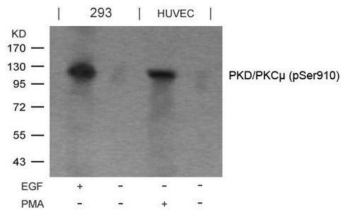 Phospho-PRKD1 (Ser910) Antibody
