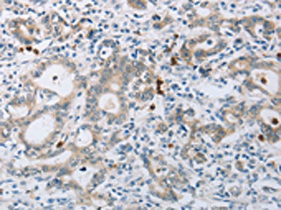 ABCB9 Antibody
