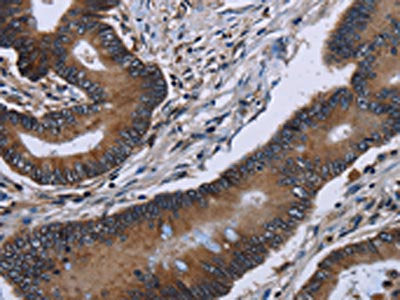 ITGAE Antibody