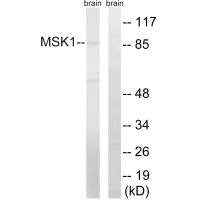 RPS6KA5 (Ab-212) Antibody