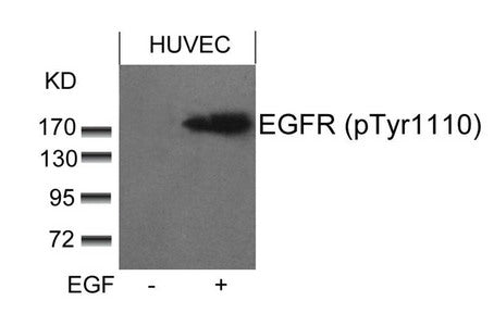 Phospho-EGFR (Tyr1110) Antibody