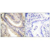 TIMP4 Antibody