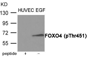 Phospho-FOXO4 (Thr451) Antibody