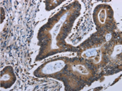 ITGAE Antibody