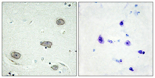 Phospho-CSF1R (Tyr809) Antibody