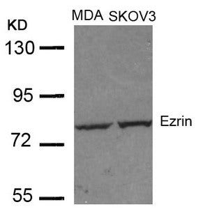 EZR (Ab-353) Antibody