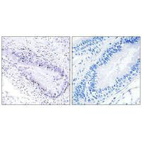 TEP1 Antibody