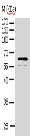 AKT1 Antibody
