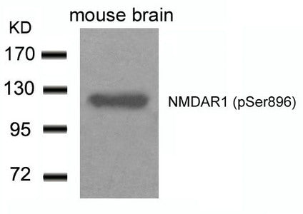 Phospho-GRIN1 (Ser896) Antibody