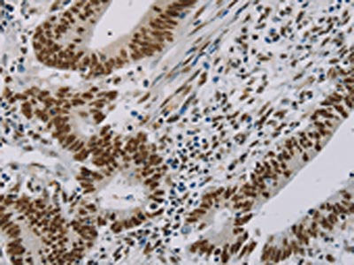 ZMAT3 Antibody