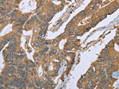 IL1RN Antibody