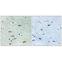IGF1R (Ab-1346) Antibody