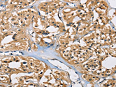 PPP3CA Antibody