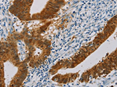 PNLIP Antibody