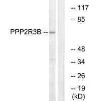PPP2R3B Antibody