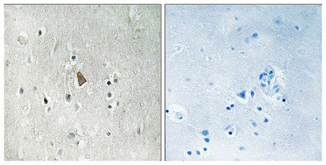 Phospho-IGF1R (Tyr1346) Antibody