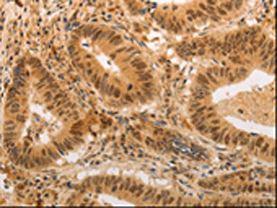 ADRA1B Antibody
