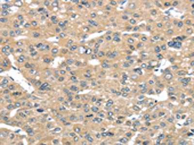 TUSC2 Antibody