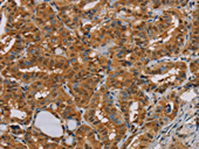 PSMC2 Antibody