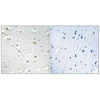 DDX3Y Antibody