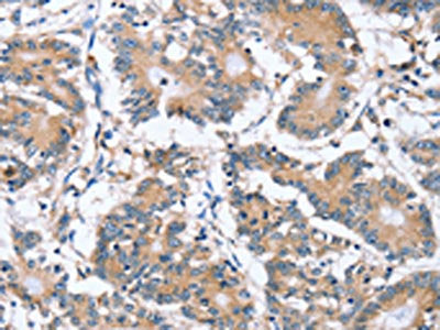 PLCZ1 Antibody
