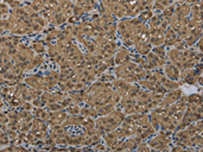 GSTP1 Antibody