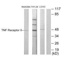 TNFRSF1B Antibody