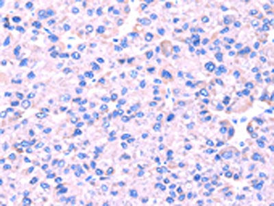 SRPK1 Antibody