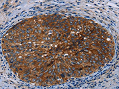 JUP Antibody