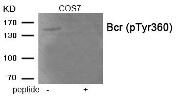 Phospho-BCR (Tyr360) Antibody