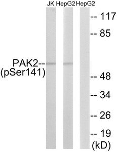 Phospho-PAK2 (Ser141) Antibody