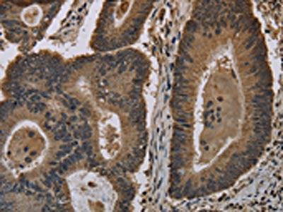 HIST1H4A Antibody