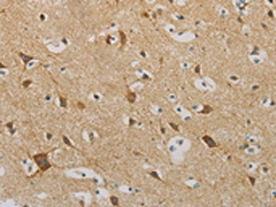 IDH3G Antibody