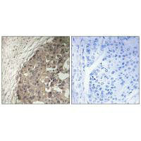 CSGALNACT1 Antibody