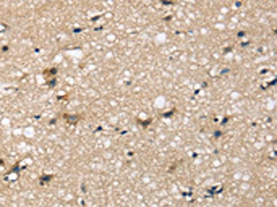 SEMA4A Antibody