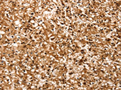RBM5 Antibody