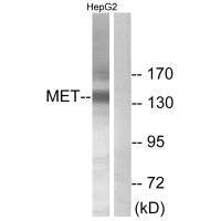 MET (Ab-1234) Antibody