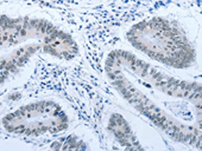 ACIN1 Antibody