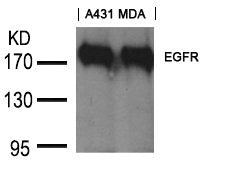 EGFR (Ab-1197) Goat Polyclonal Antibody