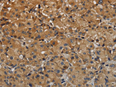 TAB1 Antibody