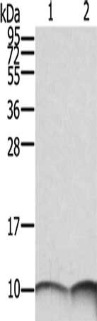 S100A6 Antibody