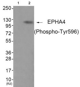 Phospho-EPHA4 (Tyr596) Antibody