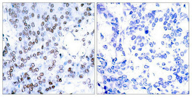 JUNB (Ab-79) Antibody