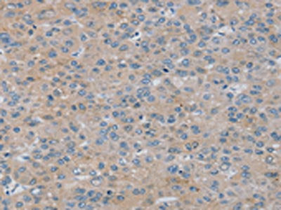 RASA4 Antibody