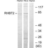 RHOBTB2 Antibody